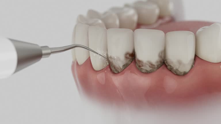 Trusted Emergency Dentist service in Blaine, MN - Dentist Open Now